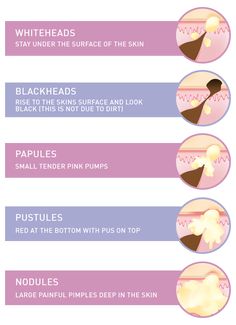 Types of Acne Infographic Nodule Acne, Painful Pimple, Pimples Under The Skin, Natural Acne Remedies, How To Get Rid Of Pimples, Acne Causes, Acne Breakout