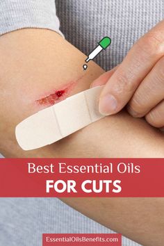 Treat minor cuts and scrapes naturally with essential oils! Discover how lavender, tea tree, and frankincense oils can disinfect wounds, reduce inflammation, and promote faster healing. Learn safe application methods and easy DIY first-aid recipes in this guide. #EssentialOils #NaturalFirstAid #WoundHealing #CutsAndScrapes #HolisticHealth #AromatherapyBenefits #DIYRemedies #HealingNaturally Essential Oil For Cuts, Wound Care, Best Essential Oils, Essential Oil Uses, Essential Oil Blends, Home Remedies, Natural Remedies, Essential Oils