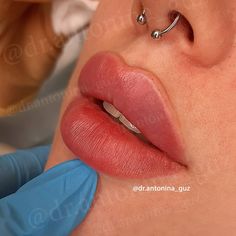 Russian Doll Lips, Russian Lips Filler, Russian Lip Filler, Russian Lips, Lip Filler, Baby Lips, Lip Shapes, Lip Injections