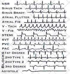 Ekg Technician Aesthetic, Ekg Interpretation Made Easy, Ekg Tech, Cardiac Health, Ekg Technician, Er Tech, Medical Assistant Student, Paramedic School, Cardiac Nurse