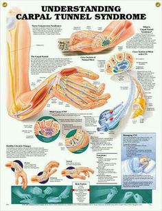 Carpal Tunnel Exercises, Carpal Tunnel Relief, Hand Therapy, Healthy Lifestyle Changes, Carpal Tunnel, Bench Press, Health Info, Occupational Therapy