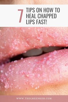 Implementing dermatologists' suggestions like avoiding harsh ingredients, replenishing the lip skin with a lip serum or lip treatment, and gently exfoliating, will heal your chapped lips in no time. Read here to discover our top tips on keeping lips soft and supple year round! Soft Lips, No Time