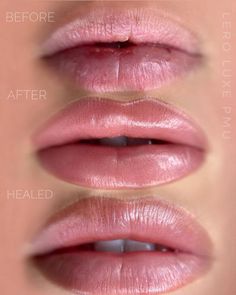 Lip Blushing Tattoo Before And After Natural, Restalyne Kysse Lips, Pmu Lips Permanent Makeup, Healed Lip Blush, Lip Shading