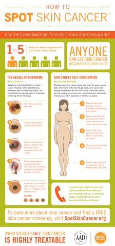 Skin Cancer Awareness Tips #skincancer #tips #infographics Health Remedy, Skin Moles, Sun Safety, Daily Health Tips, Good Health Tips, Wear Sunscreen, Healthy Food Choices, Healthy Eating Tips, Skin Care Products