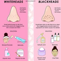 What To Do For Blackheads, Acne Guide, Skincare Niacinamide, Obličejové Masky, Skin Hacks, Types Of Facials, Skincare Advice, Nose Makeup, Face Skin Care Routine