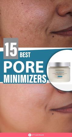 Pore Minimizer Diy, Open Pores On Face, Best Pore Minimizer, Big Pores, Forehead Acne, Lotion For Oily Skin, Oily Skin Acne, Pore Minimizer, Cream For Oily Skin