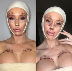 Botched Halloween Makeup, Surgery Halloween Costume, Plastic Surgery Costume, Plastic Surgery Halloween, Plastic Surgery Art, Plastic Surgery Makeup