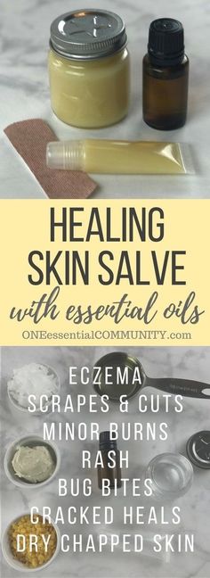 Essential Oil Healing, Healing Salve Recipe, Healing Skin, Salve Recipes, Homemade Essential Oil, Healing Salves, Diy Kosmetik, Essential Oils For Skin, Cracked Heels