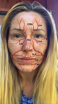 Facial Anatomy For Injectors, Anatomy Of Face, Facial Muscles Anatomy, Face Injections, Facial Veins, Facial Injections, Skin Anatomy, Aesthetic Dermatology, Facial Anatomy