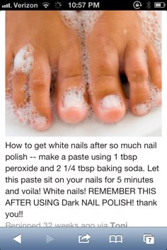 White toenails! Not the best to use if you want natural nails because they will… Airbrush Make Up, Baking Soda Shampoo, Diy Products, Beauty Diy, Beauty Remedies, Beauty Ideas, Health And Beauty Tips, Girl Stuff, Beauty Treatments