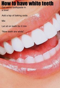 White Teeth Tips, Baking Soda Teeth, Baking Soda Teeth Whitening, Get Whiter Teeth, Teeth Whitening Homemade, Teeth Whitening Remedies, Teeth Whitening Diy, Trening Fitness