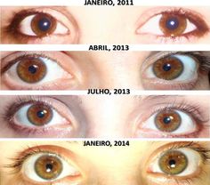 Change Your Eye Color, Lighten Skin Tone, Estilo Taylor Swift, Lighten Skin, Hazel Eyes, روتين العناية بالبشرة, Skin Care Treatments, Beauty Skin Care Routine