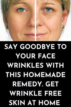 >>CHECK IT OUT<< SHE REMOVED ALL WRINKLES WITH THIS REMEDY Face Wrinkles Anti Aging, Natural Wrinkle Remedies, Face Wrinkles Remedies, Wrinkles Remedies, Home Remedies For Wrinkles, Organization Skincare, Old Skin, Wrinkle Remedies, Skin Wrinkles