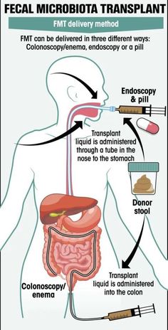 High Iq, Gut Microbiome, Very Tired, Brain Fog, Live Long, Immune System, Science, Health