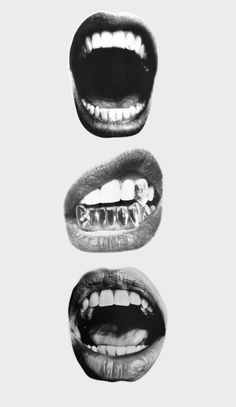 three images of mouth shapes with teeth and gums in black and white, each showing the same person's upper lip