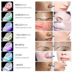 Acne Light Therapy, Led Facial Mask, Led Light Therapy Mask, Led Facial, Light Therapy Mask, Acne Mask, Led Face Mask, Types Of Acne