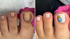 Clean Toenails, Rose Gal, Nail Designs Spring, Toe Nails, Spring Nails, Manicure, Nail Designs, I Hope, Nail Art