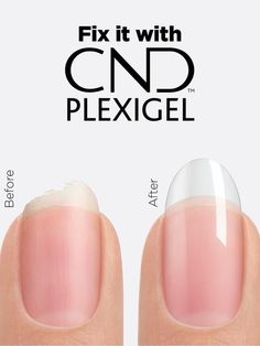 CND Plexigel Brush-In-A-Bottle Gel Nail Extension System The CND Plexigel System Is Versatile And Convenient Nail Enhancement System in a bottle.Provides Up To 3+ Weeks Of Strength, Length, And Shape. Fill It with Shaper or Builder: Save Cracked Nails With Wearable Patches. Fix It with Builder: Repair Broken Nails. Shape It with Shaper: Plump And Shape Flat Nails. Build It with Builder: Create Customizable Length. Basecoat with Bonder Topcoat with Protector Top Coat Repair Broken Nail, Cracked Nails, Remove Gel Polish, Weak Nails, Gel Nail Extensions, Broken Nails, Gel Nail Tips, Almond Nail, Nail Forms