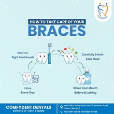 braces Dental Braces Creative Ads, Dentist Social Media, Dental Health Week, Dental Advertising, Dental Photos, Dental Social Media, Dental Images, Dental Posts, Teeth Design