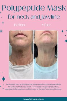 Pink background with title "polypeptide mask for neck and jawline" with before and after photos of woman's neck wrinkles. Peptide Bond, Decrease Inflammation, Anti Aging Tips, Best Anti Aging