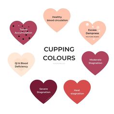 Cupping Points, Benefits Of Cupping, Massage Therapy Quotes, Hijama Cupping, Sore Body, Fire Cupping, Massage Marketing, Massage Quotes, Cupping Massage