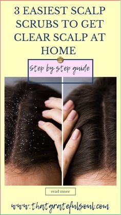 Here are Easy and best diy scalp scrub,diy scalp scrub for buildup,for hair growth, for dandruff hair growth, for itchy scalp,for dry scalp,diy scalp scrub oily hair,diy scalp scrub recipes, for psoriasis. #haircare #diy #homeremedies Clean Scalp Build Up Diy, Homemade Scalp Scrub For Dandruff, Diy Dry Scalp Mask, Clean Scalp Diy, How To Make A Scalp Scrub, Diy Scalp Scrub For Itchy Scalp, Diy Scalp Scrub For Buildup And Dandruff, Natural Remedies For Dry Scalp, Diy Scalp Scrub For Dandruff