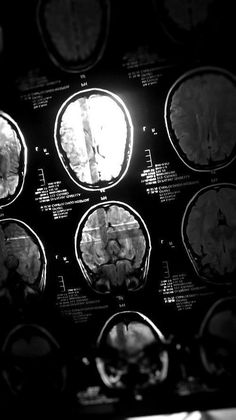 mri images showing different areas of the brain