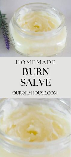 Burn Salve, Our Oily House, Burn Ointment, Cold Sores Remedies, Cleaner Recipes, Natural Sleep Remedies, Natural Cold Remedies, Natural Cough Remedies