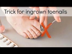 This video is an edited version of a small part of our "Pedicure Basics" webinar. You can watch full version for free, as well as other webinars on this page... Toenail Pain, Nail Problems, Ingrown Toenail, Ingrown Nail, Popular Nail Designs, Nail Pictures, Dental Floss, Homemade Remedies