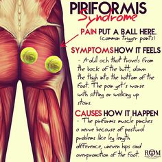 Piriformis Syndrome Exercises, Sciatic Nerve Pain Relief, Piriformis Muscle, Hip Pain Relief, Piriformis Stretch, Sciatica Exercises, Piriformis Syndrome, Sciatica Pain Relief, Back Pain Remedies