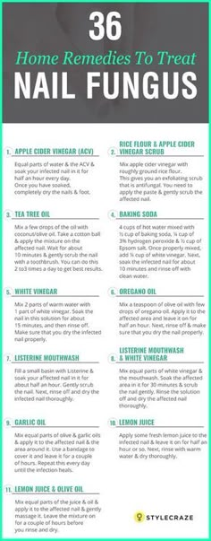 Toenail Fungus Remedies, Nail Fungus Remedy, Vicks Vaporub, Toenail Fungus, Nail Fungus, Nail Health, Natural Health Remedies, Natural Home Remedies, Young Living