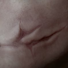 a close up view of the skin on someone's stomach