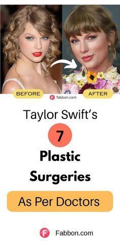 Plastic Surgery Fails, Anatomy Dental, Surgery Doctor, Aesthetic Doctor, Facial Fillers, Facial Plastic Surgery