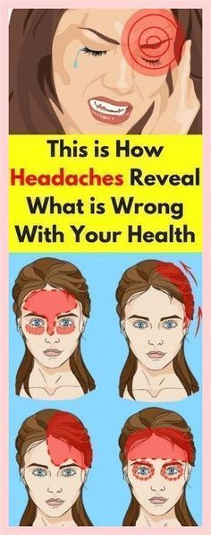 This is How Headaches Reveal What is Wrong With Your Health And How To Fix The Problem Naturally Treat Yeast Infection, Nutritional Snacks, Diet Drinks, Healthy Beauty, Natural Treatments, Finger Food, Health Remedies