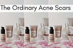 the ordinary acne scars, banish acne scars The Ordinary Products For Acne, Ordinary Products For Acne, Ordinary For Acne, The Ordinary For Acne, The Ordinary Acne, The Ordinary Azelaic Acid, Products For Acne, The Ordinary Retinol, Amazon Skincare