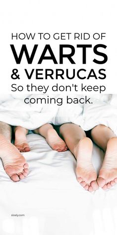 Get rid of verrucas naturally and stop them coming back with these 2 super powered natural verruca treatments ... How To Treat Warts, Verruca Removal, What Causes Warts, Flat Warts, Don't Come Back, Remove Warts