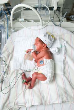 a baby in a hospital bed with an oxygen tube attached to it's head