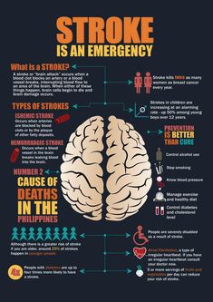 Medical Knowledge, Home Health Care, Interesting Ideas, Health Info, Interesting Stuff, Emergency Medical, Home Health, Migraine, Random Things