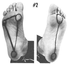 Feet: The Story of the Long Second Toe - Bonnie Prudden Myotherapy