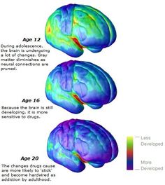 Risky Behavior, Neuroscience Art, Playful Parenting, Age Progression, Gain Knowledge