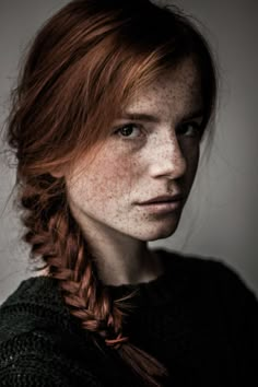 15+ Freckled People Who'll Hypnotize You With Their Unique Beauty Luca Hollestelle, People With Red Hair, Beautiful Freckles, Fair Complexion, Freckles Girl, Red Heads, Pale Skin, Interesting Faces