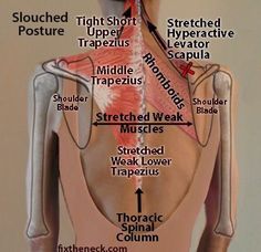 Shoulder Blade Stretch, Muscle Stretches, Middle Back Pain, Cervical Spine, Upper Back Pain, Hip Flexor, Massage Techniques, Shoulder Pain