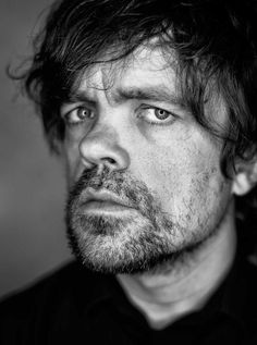 a black and white photo of a man with frecky hair looking at the camera