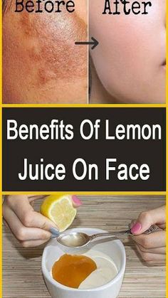 Lemon Juice On Face, Benefits Of Lemon Juice, Lemon Juice For Skin, Lemon Juice Face, Juice For Skin, Lemon Face, Lemon Juice Benefits, Benefits Of Lemon