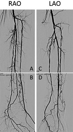 four different views of the branches of an animal's body, with their roots exposed