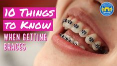 10 Things to Know When Getting Braces - YouTube Braces Pain, Cute Braces, Dental Braces, Manhattan Bridge, Bad Things, Very Excited, The Bad, Things To Know