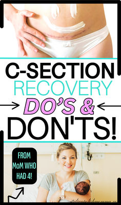 C-section recovery tips and c-section recovery advice, the best tips to recover fast and safe during a c-section recovery Postpartum C Section, C Section Recovery Timeline, C Section Workout, Postpartum Recovery Kit, Postpartum Must Haves, Post Pregnancy Body, C Section Scars, Pregnancy Hacks, First Time Pregnancy