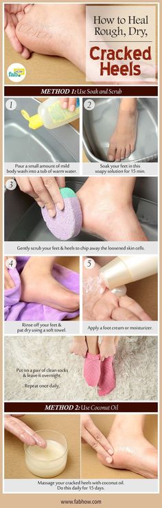 Спонж Beauty Blender, Heal Cracked Heels, Coconut Oil Massage, Dry Cracked Heels, Healthy Book, Reduce Swelling, Cracked Heels, Beauty Remedies, Skin Remedies