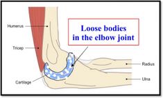 Radius And Ulna, Activities Of Daily Living, Ct Scan, Tennis Elbow, Body Form, Blood Test, Book Your Appointment, Pain Free, Daily Activities