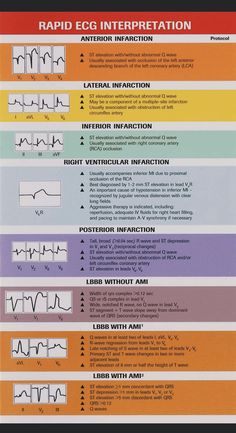 Learn Ekg Cheat Sheets, Cardiac Perfusion Technology, Echocardiography Study, Acls Study Guide 2022, Paramedic Notes, Cvicu Nursing, Cath Lab Nursing, Skills For Resume, Cardiovascular Nursing